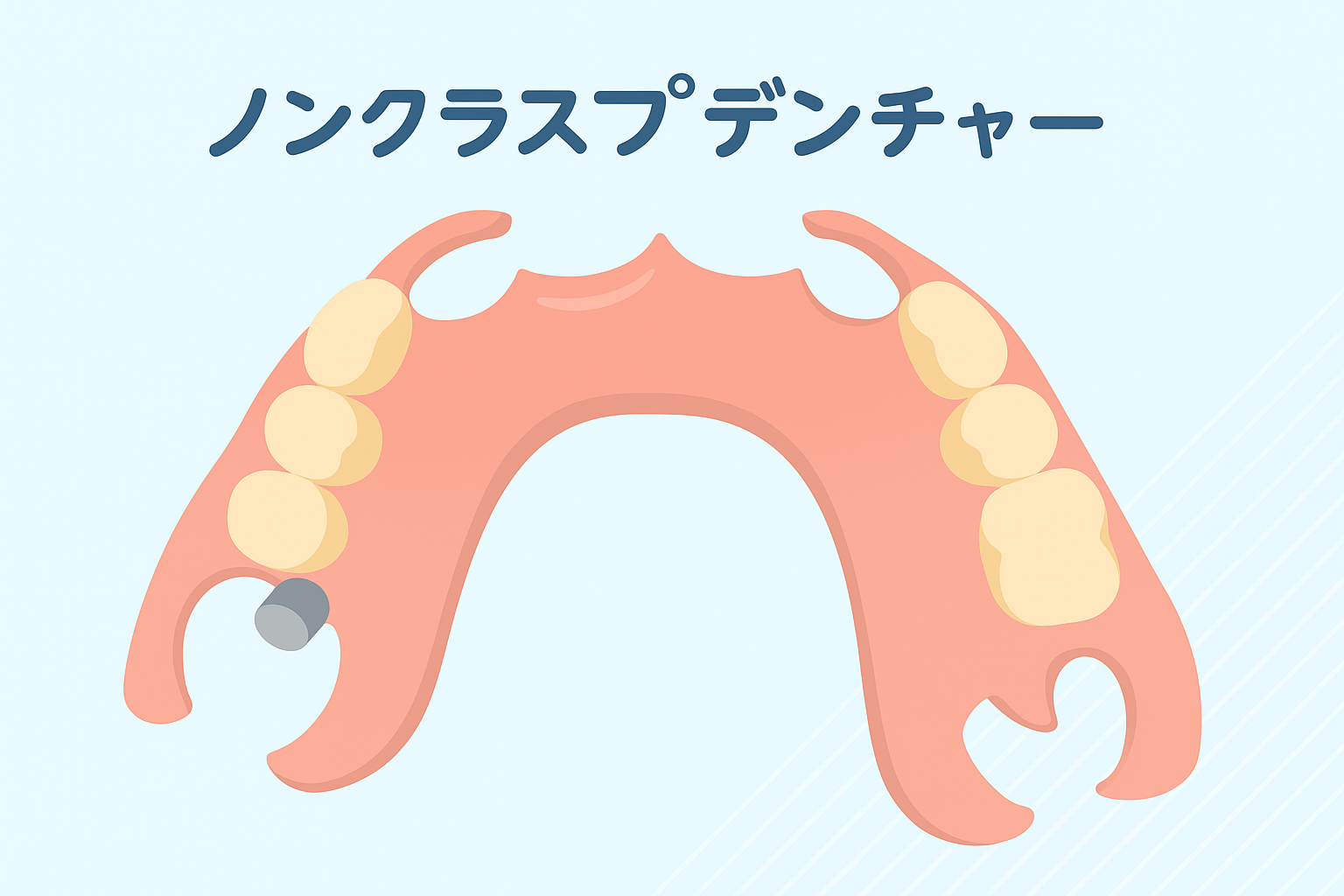 もう悩まない!あなたにぴったりの義歯(入れ歯)を見つける完全ガイド