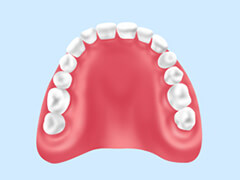 レジン床義歯（保険）