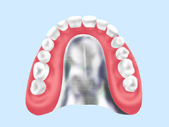 金属床義歯（自費）